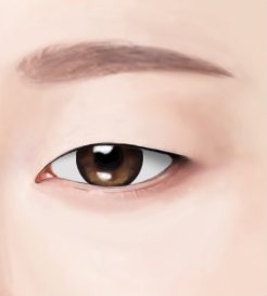 수술전 눈 그림