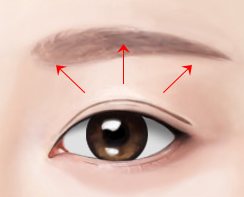눈매교정술 도식 — 쌍꺼풀 위로 눈뜨는 힘 방향을 가리키는 빨간 화살표 3개